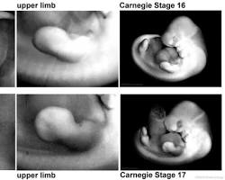 Scientific illustration of a 6-week embryo showing C-shape curve and temporary tail